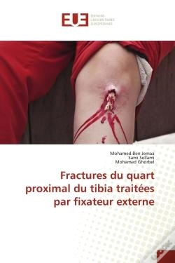 Capa do artigo Fractures Du Quart Proximal Du Tibia Traitees Par Fixateur Externe