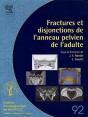 Fractures Et Disjonctions De L'Anneau Pelvien De L'Adulte - Preview