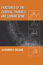 Fractures Of The Cervical, Thoracic, And Lumbar Spine - Preview