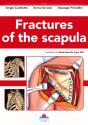 Fractures Of The Scapula - Preview