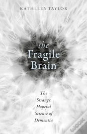 Capa do artigo Fragile Brain