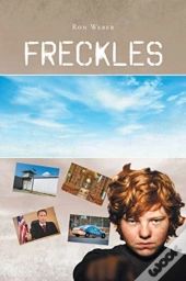 Freckles