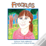 Freckles