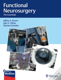 Capa do artigo Functional Neurosurgery