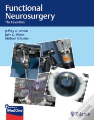 Functional Neurosurgery