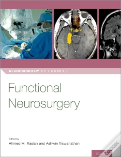Capa do artigo Functional Neurosurgery
