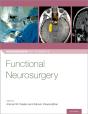 Functional Neurosurgery - Preview