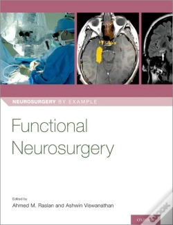 Capa do artigo Functional Neurosurgery
