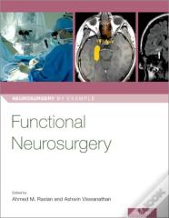 Functional Neurosurgery