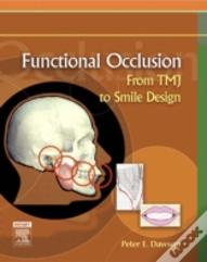 Functional Occlusion