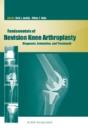 Fundamentals Of Revision Knee Arthroplasty - Preview