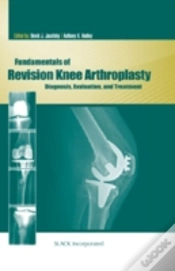 Capa do artigo Fundamentals Of Revision Knee Arthroplasty