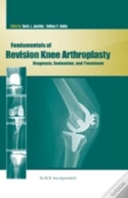 Capa do artigo Fundamentals Of Revision Knee Arthroplasty