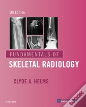 Capa do artigo Fundamentals Of Skeletal Radiology E-Book