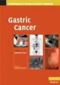 Gastric Cancer - Preview