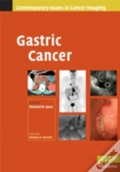 Capa do artigo Gastric Cancer