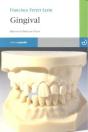Gingival - Preview