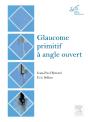 Glaucome Primitif À Angle Ouvert - Preview