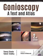 Gonioscopy: A Text And Atlas
