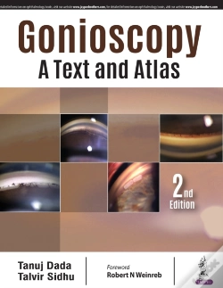Capa do artigo Gonioscopy: A Text And Atlas