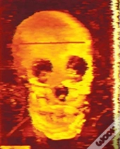 Graves