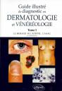 Guide Illustré De Diagnostic En Dermatologie Et Vénéréologie - Tome 1 - Preview
