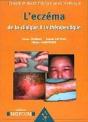 Guide Pratique De La Dermatologie ; L'Eczéma : De La Clinique À La Thérapeutique - Preview