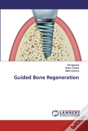 Capa do artigo Guided Bone Regeneration