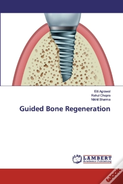 Capa do artigo Guided Bone Regeneration