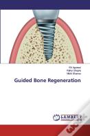 Guided Bone Regeneration