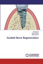 Guided Bone Regeneration - Preview
