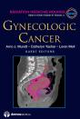 Gynecologic Cancer - Preview