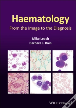 Capa do artigo Haematology