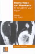 Haemorrhage And Thrombosis For The Mrcog And Beyond