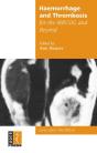 Haemorrhage And Thrombosis For The Mrcog And Beyond - Preview