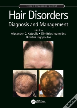 Capa do artigo Hair Disorders