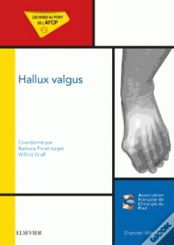 Capa do artigo Hallux Valgus