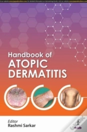 Capa do artigo Handbook Of Atopic Dermatitis