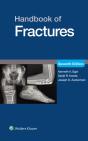 Handbook Of Fractures - Preview