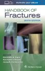 Handbook Of Fractures - Preview