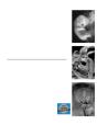 Handbook Of Pediatric Autopsy Pathology - Preview