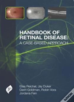 Capa do artigo Handbook Of Retinal Disease: A Case-Based Approach