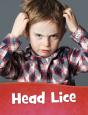 Head Lice - Preview