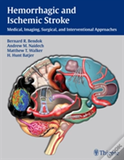 Capa do artigo Hemorrhagic And Ischemic Stroke