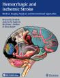 Hemorrhagic And Ischemic Stroke - Preview