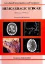 Hemorrhagic Stroke - Preview