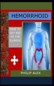 Hemorrhoid
