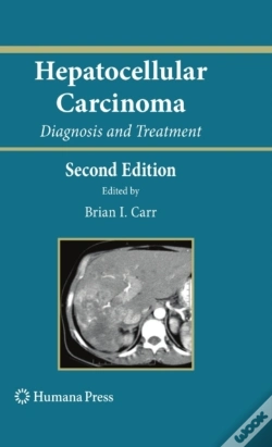 Capa do artigo Hepatocellular Carcinoma