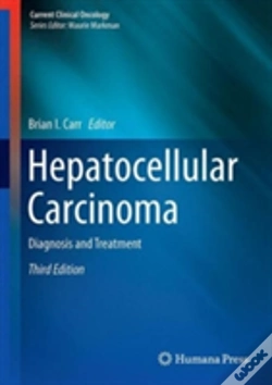 Capa do artigo Hepatocellular Carcinoma