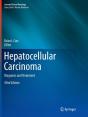 Hepatocellular Carcinoma - Preview
